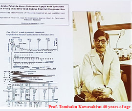 Indian Society of Kawasaki Disease